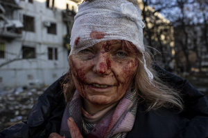 Fotoğrafıyla Rusya-Ukrayna Savaşı'nın simgesi olan Olena Kurilo savaşın ikinci yılında evine döndü